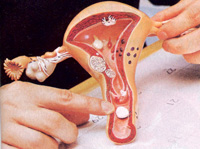 �D�ƌ��Ҿ��ѣ��׎����������N�D�Ʋ�