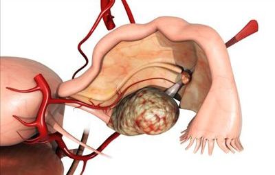  怎樣才能讓卵巢常“年輕”？