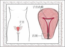 子宮出血如何醫治？