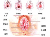第五代韓式無(wú)痕處女膜修復(fù)術(shù)，10分鐘還你女兒身