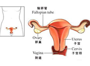 陰道異常修復 還石女做女人的權利