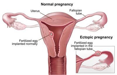 宮頸炎的危害大嗎？該如何治療？